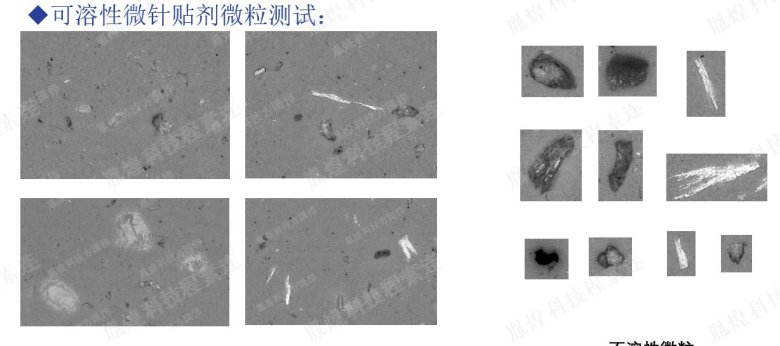 可溶性微針貼劑